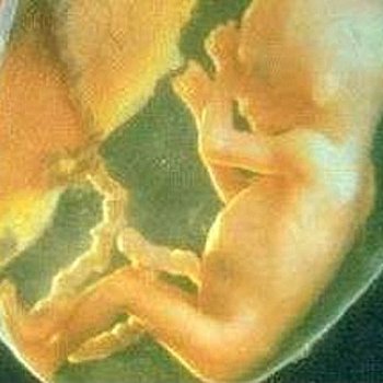 Mifegyne Abtreibung