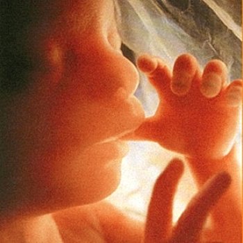 Abtreibung 22 Woche