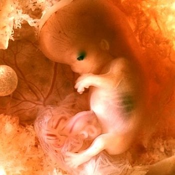 Abtreibung Baby